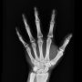 High-resolution X-ray capturing the bones of a human hand, displaying skeletal anatomy.